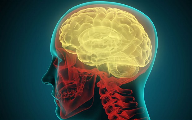 Click image for larger version. 

Name:	CRW0K4-brain_2703713b.jpg 
Views:	3190 
Size:	45.4 KB 
ID:	11329