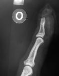 Click image for larger version. 

Name:	xray.jpg 
Views:	1971 
Size:	82.9 KB 
ID:	2321