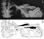 Click image for larger version. 

Name:	xray3.jpg 
Views:	394 
Size:	64.8 KB 
ID:	2326